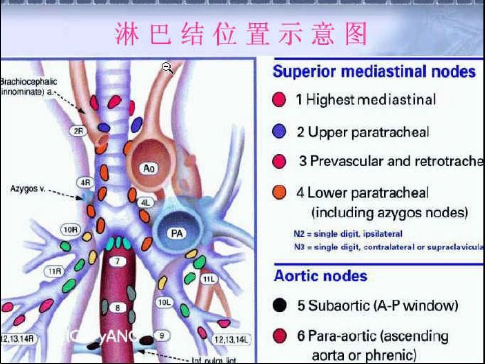 肿瘤科-肺癌-_第13页