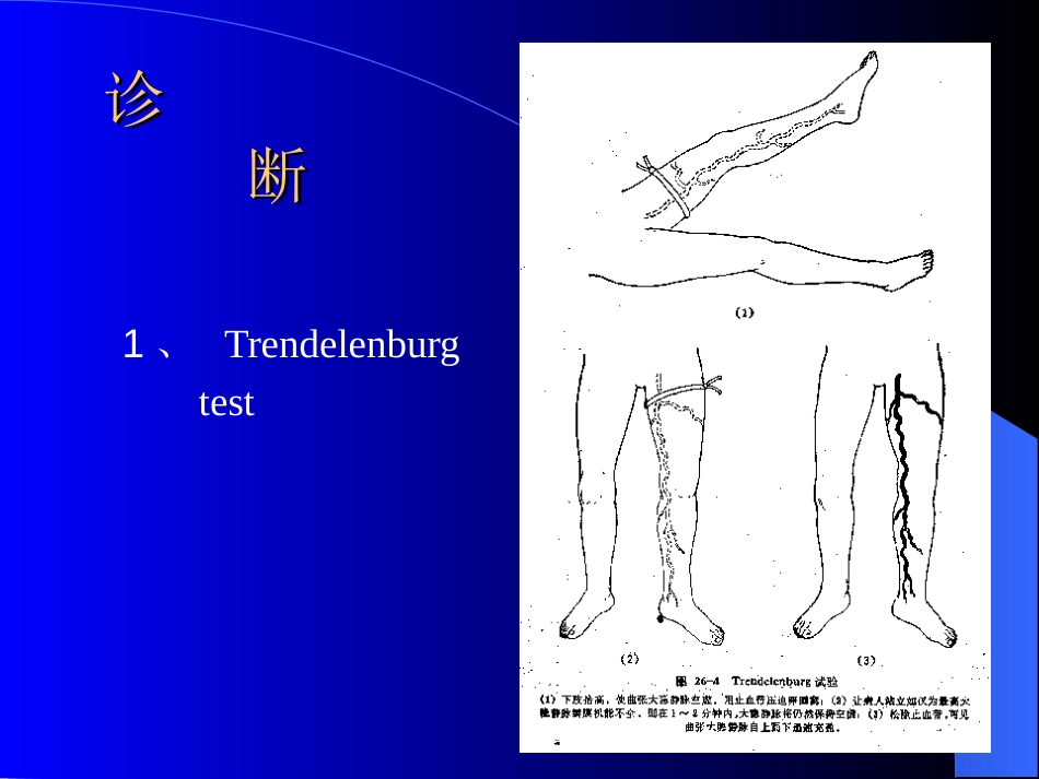 周围血管与淋巴管疾病test_第12页