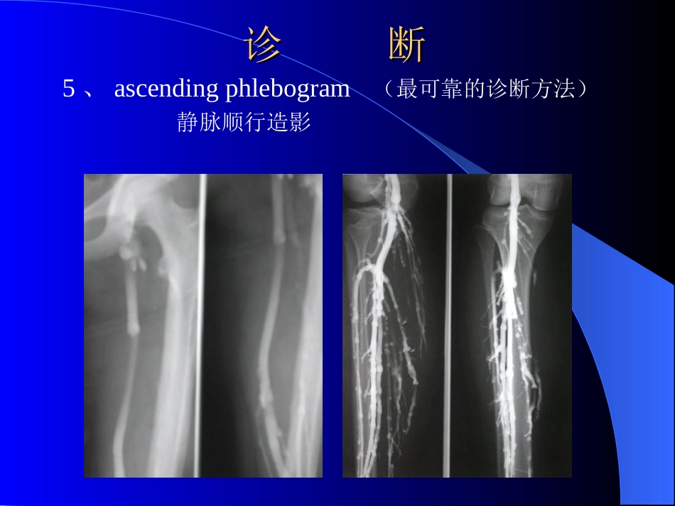 周围血管与淋巴管疾病test_第15页