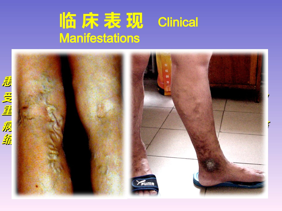 周围血管和疝_第10页