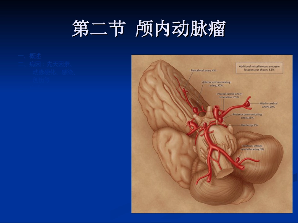 血管病-课时_第12页