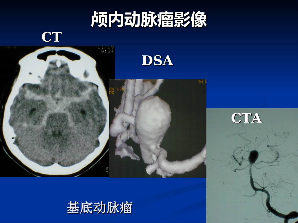 血管病-课时_第15页