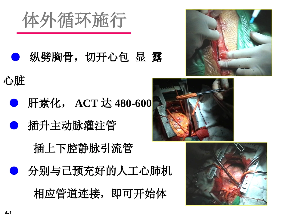 先心病教案 统一版_第15页