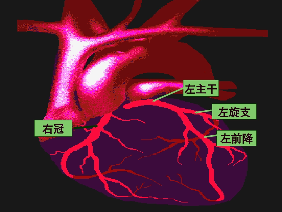 心血管内科-冠心病(课件)_第6页