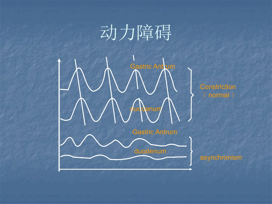 消化内科-功能性消化不良_第8页