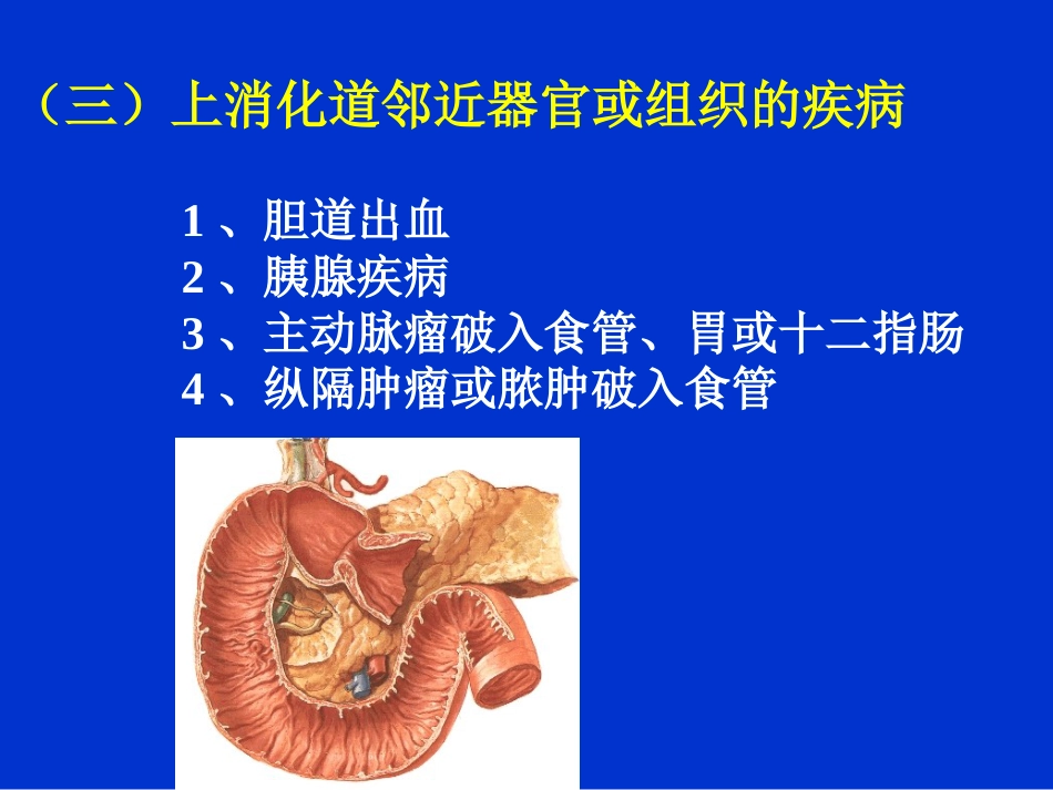 消化内科-上消化道出血课件_第15页