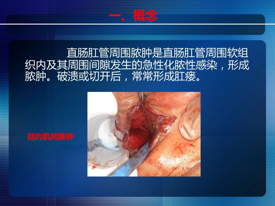 消化内科-直肠肛管疾病_第10页