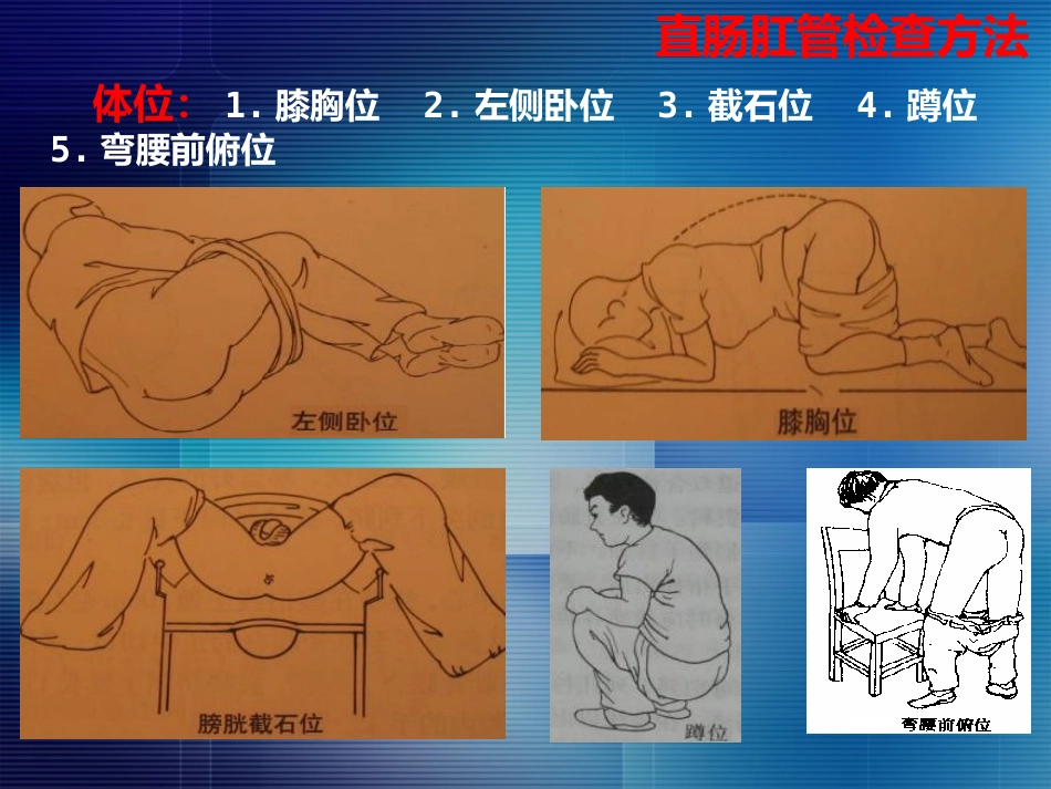 消化内科-直肠肛管疾病_第7页