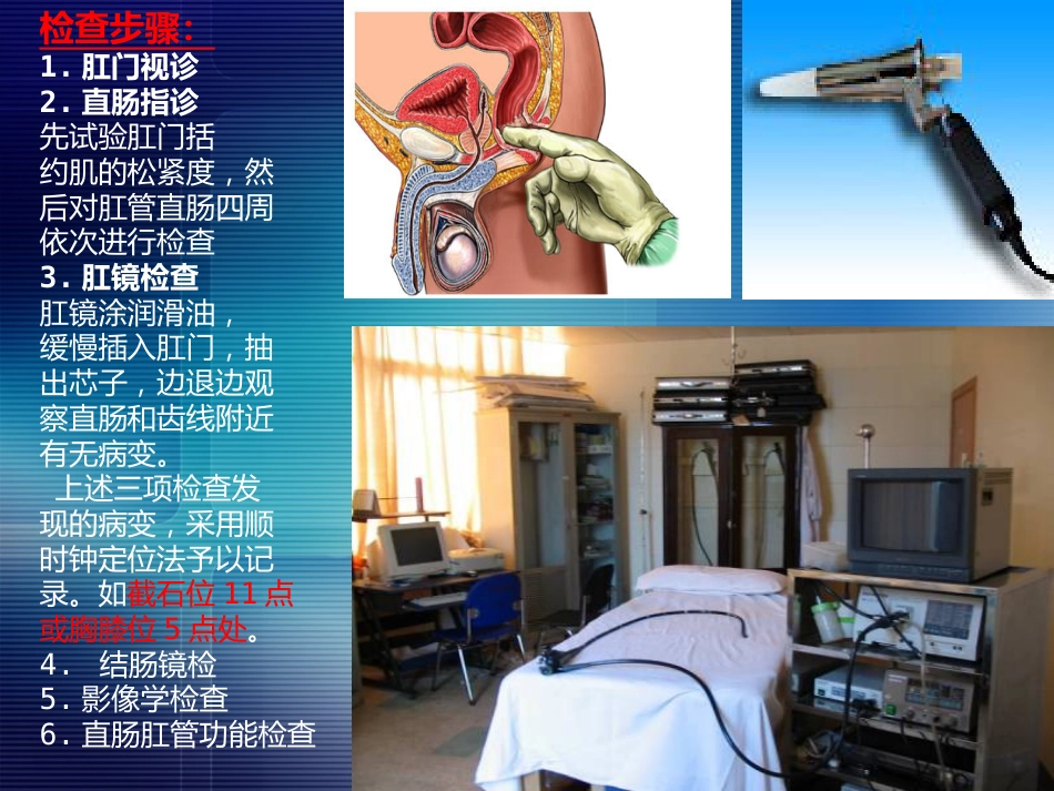 消化内科-直肠肛管疾病_第8页