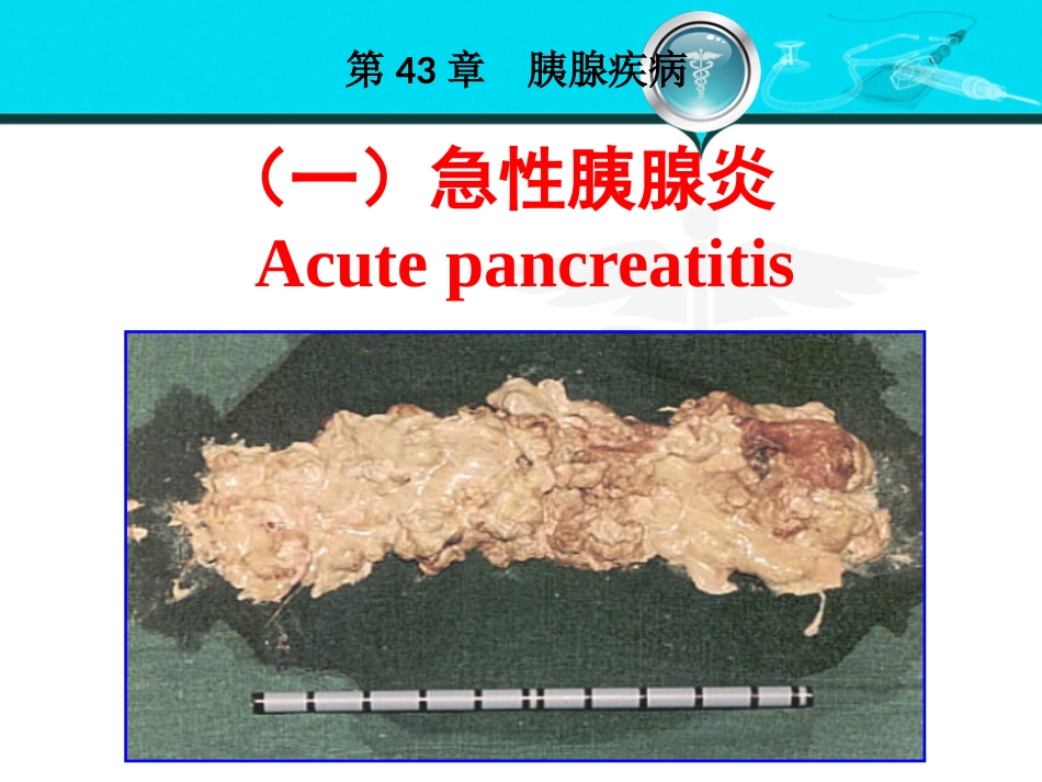 消化内科-胰腺疾病_第10页