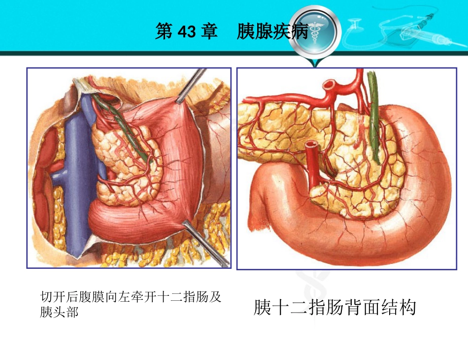 消化内科-胰腺疾病_第6页