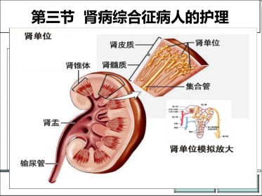 肾病综合征PPT