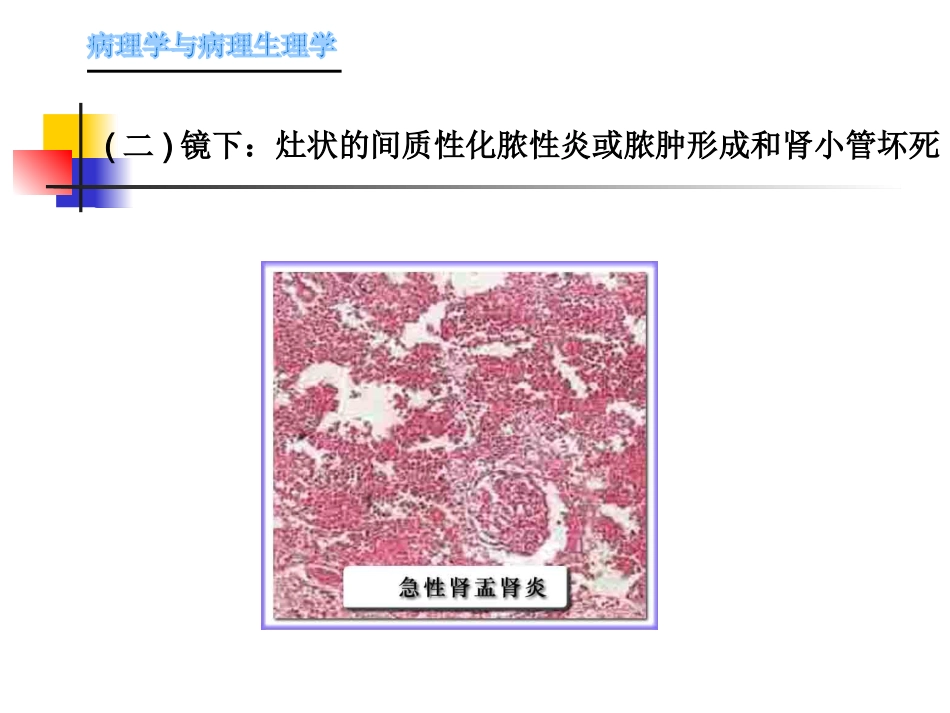 肾内科-肾盂肾炎1_第9页