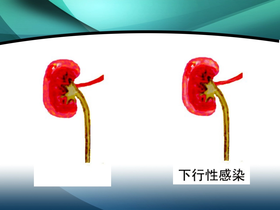 肾内科-肾盂肾炎2_第8页