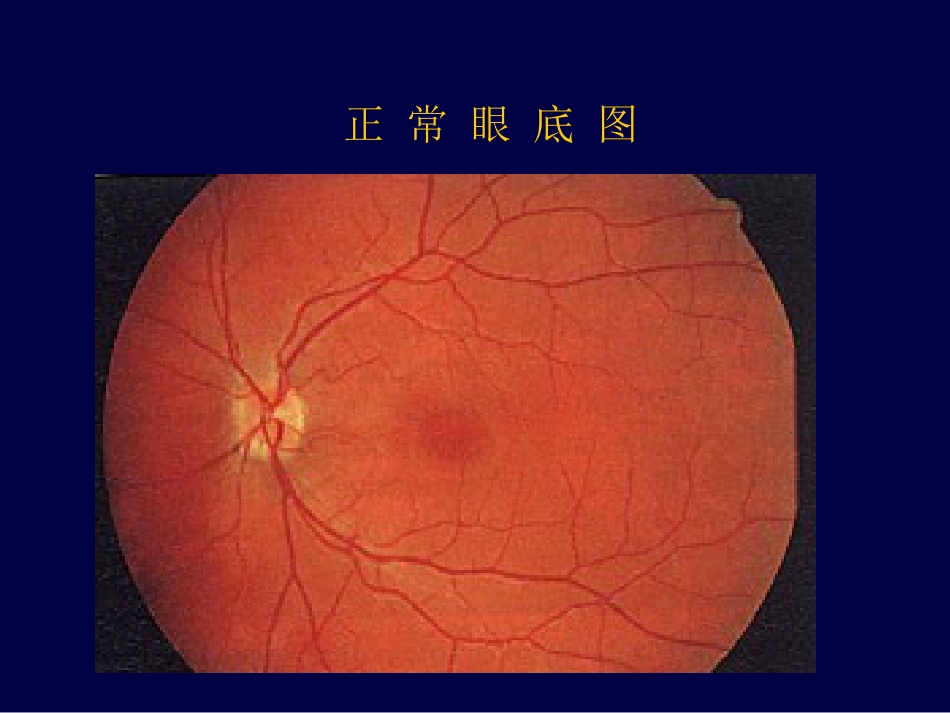 眼底病、眼与全身病备份_第6页