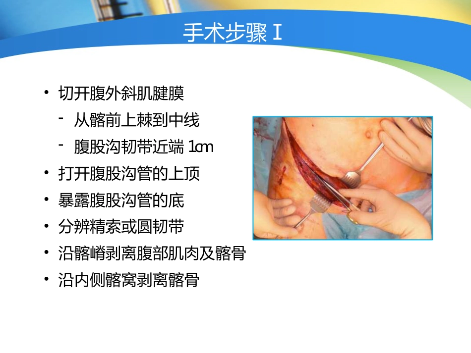 骨盆髋臼 入路选择_第9页