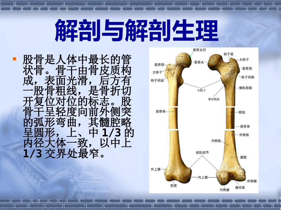 股骨干 骨折_第3页