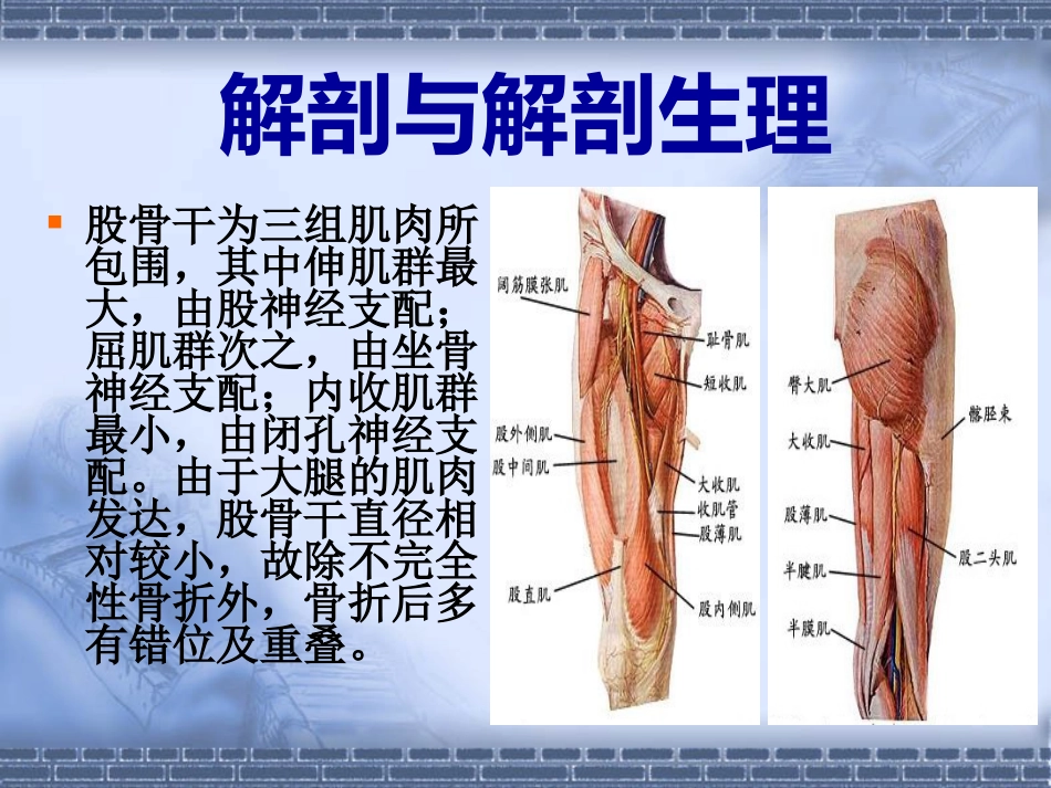 股骨干 骨折_第4页