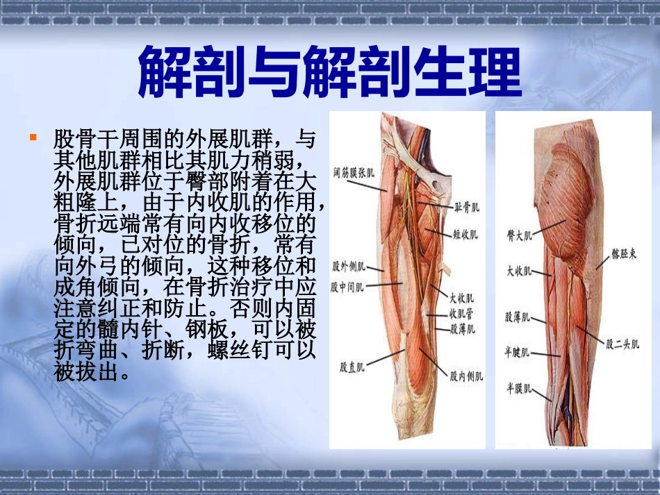 股骨干 骨折_第5页