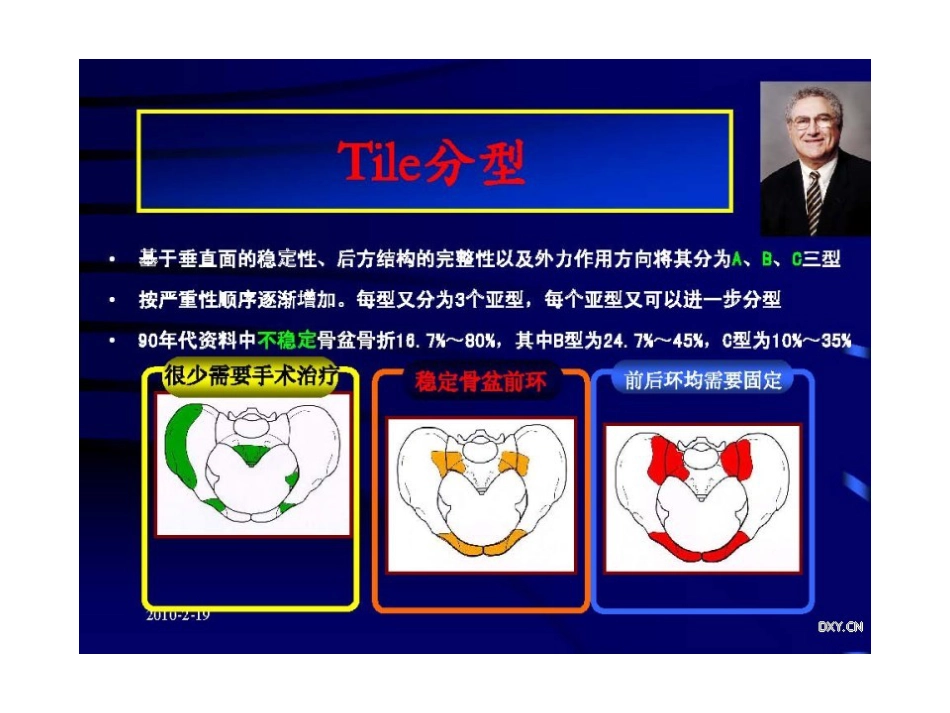 骨盆 与髋臼骨折的诊断与分型_第13页
