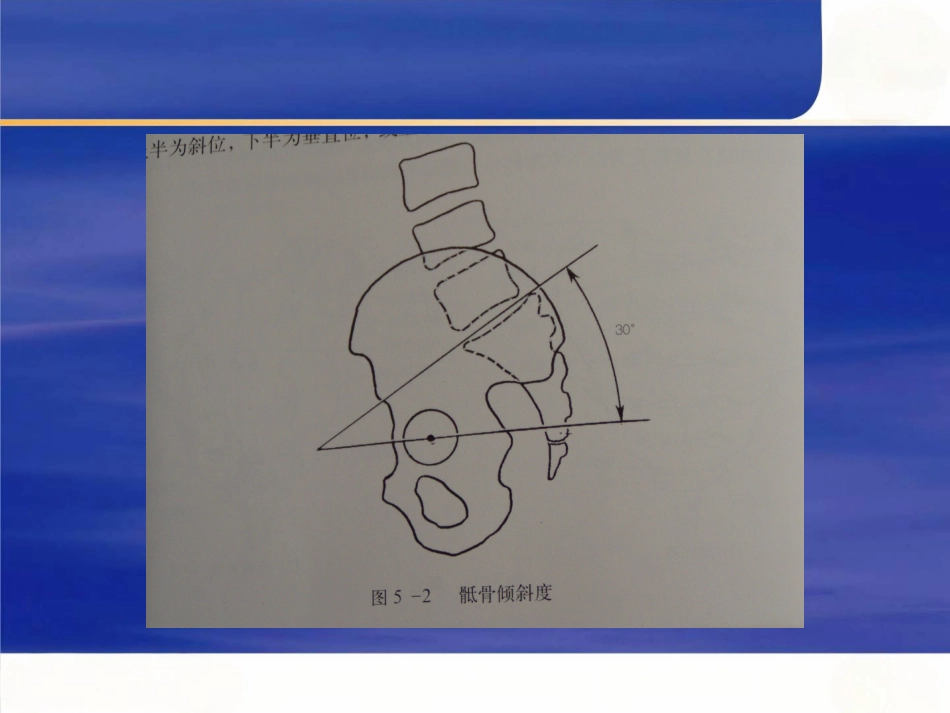 骨盆的 临床解剖_第6页