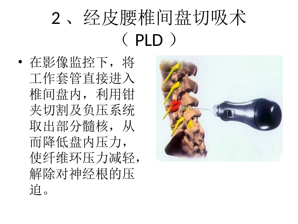 脊柱微创 技术_第7页
