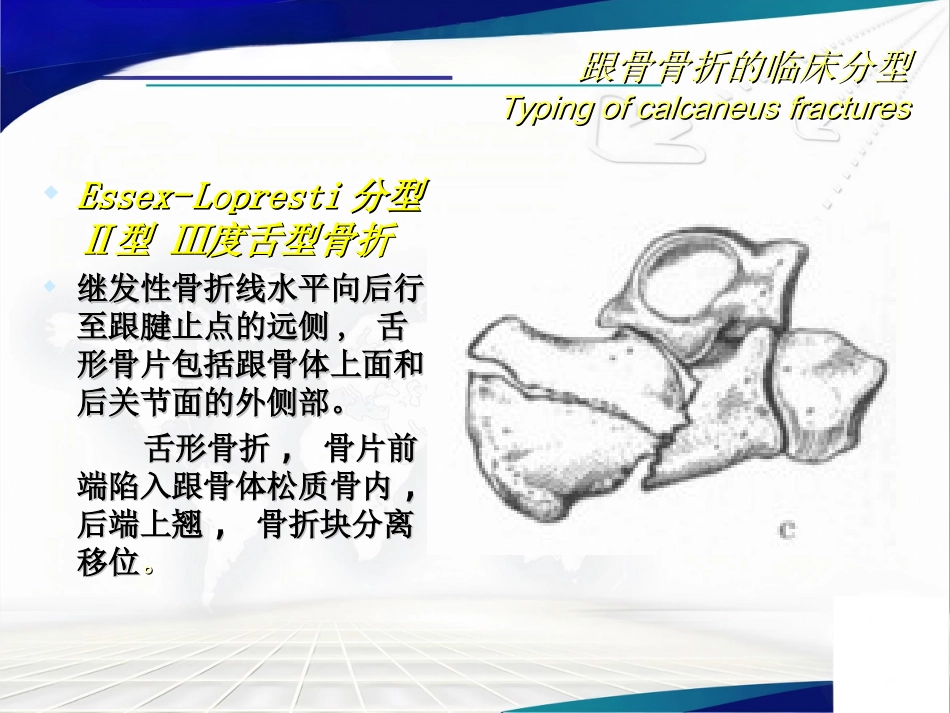 跟骨骨折 的分型与治疗讲座_第14页