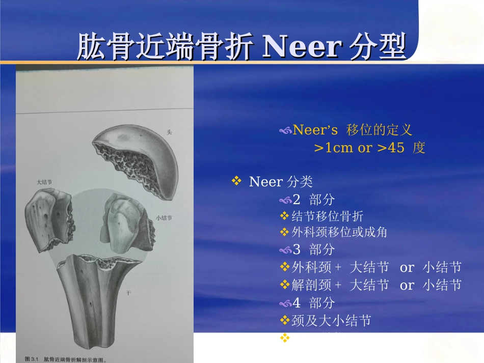 肱骨近端骨折 Neer分型及治疗_第4页
