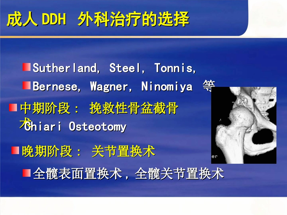 成人髋关节 发育不良的手术选择_第4页