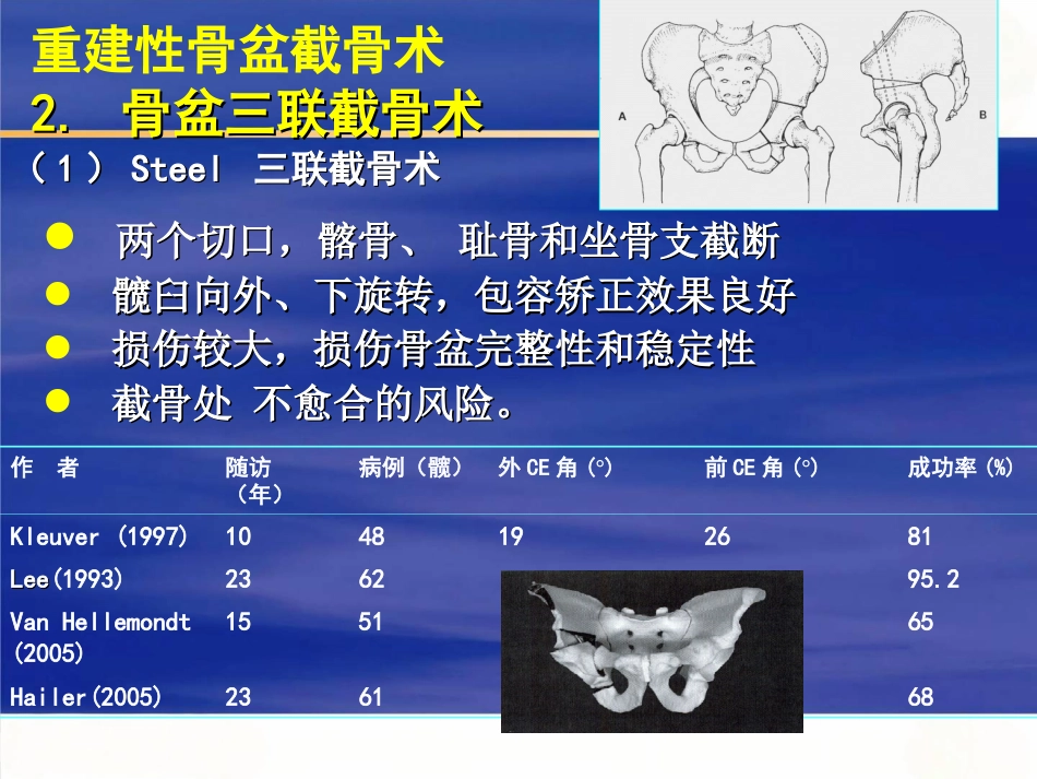 成人髋关节 发育不良的手术选择_第6页