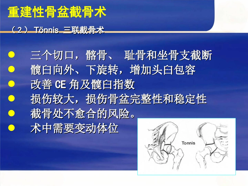 成人髋关节 发育不良的手术选择_第7页
