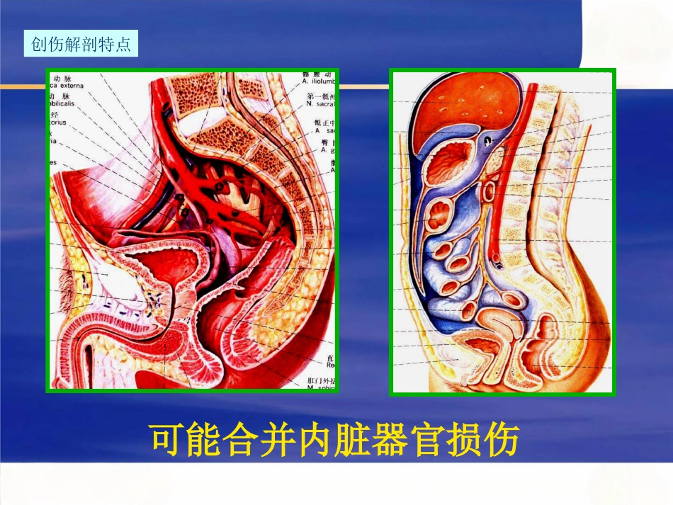 骨盆骨折 急诊处理的一般原则_第8页
