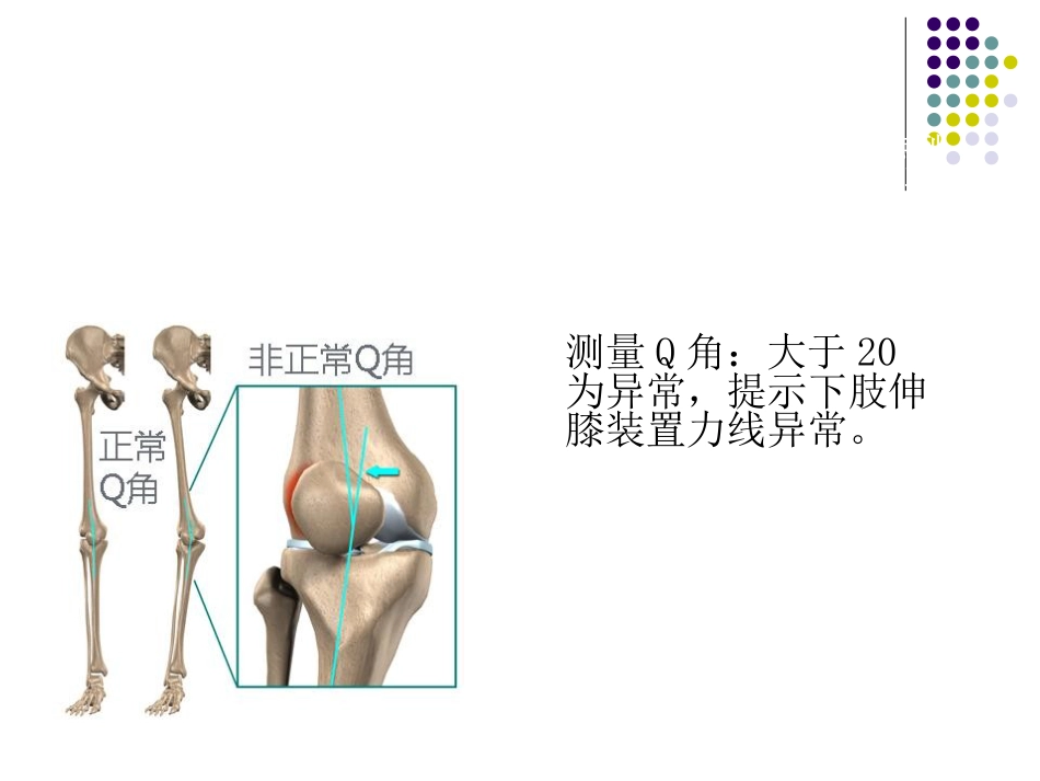 复发性 髌骨脱位_第14页