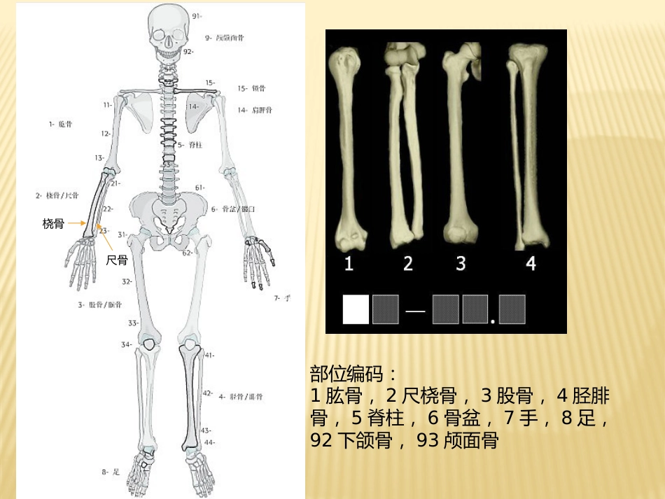 骨折 AO分型_第4页