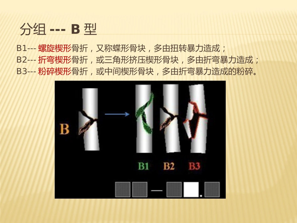骨折 AO分型_第8页