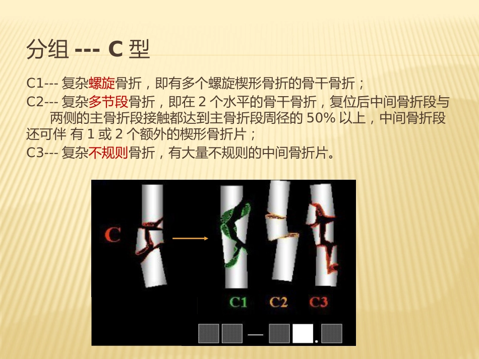 骨折 AO分型_第9页