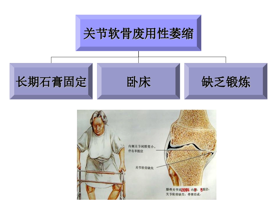 骨关节炎 治疗_第7页