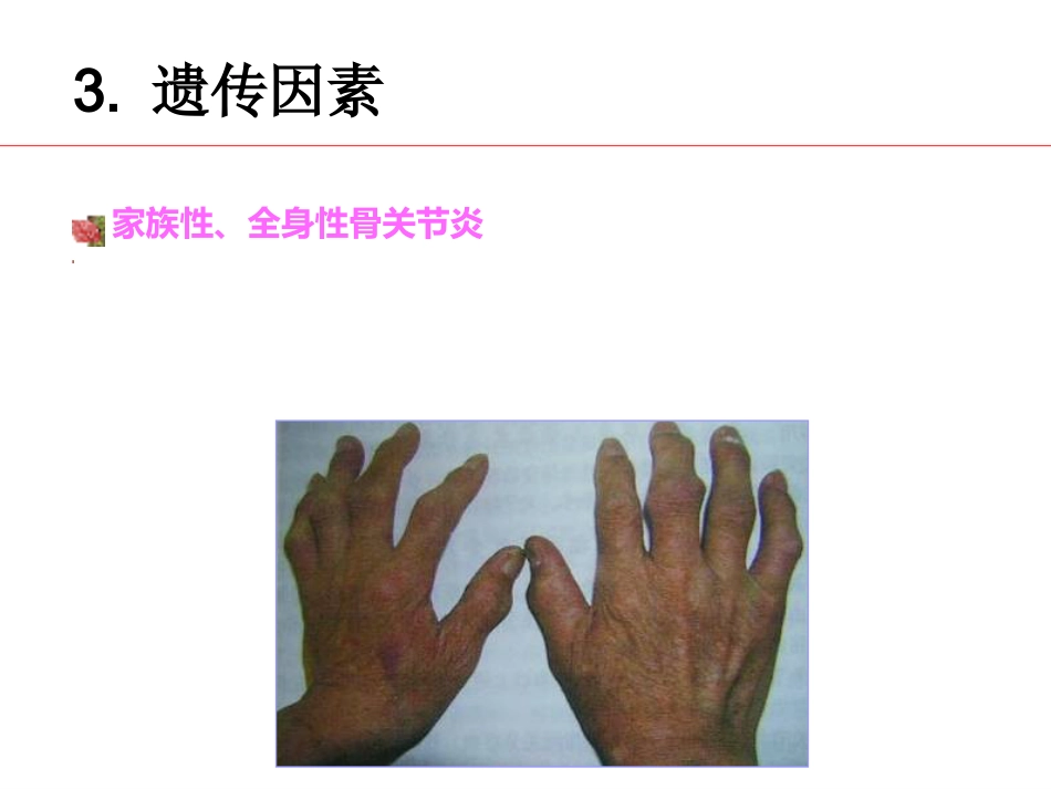 骨关节炎 治疗_第8页