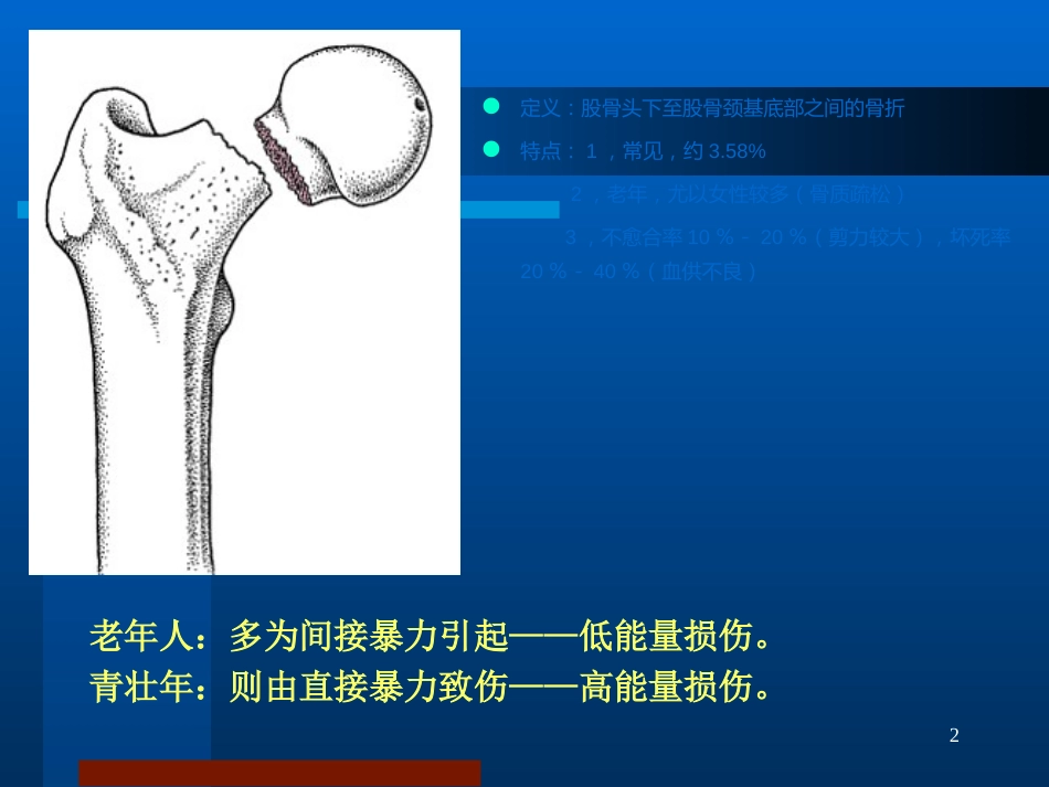 股骨颈骨折 治疗选择_第2页