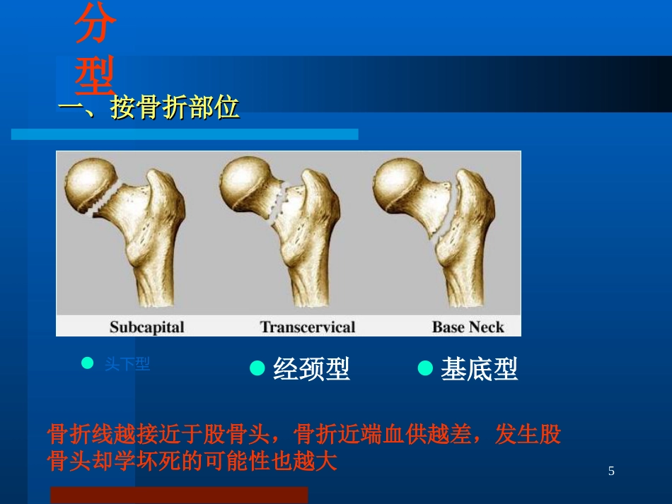 股骨颈骨折 治疗选择_第5页