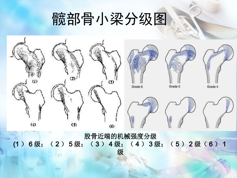 股骨粗隆间骨折股骨转子间骨折_第7页