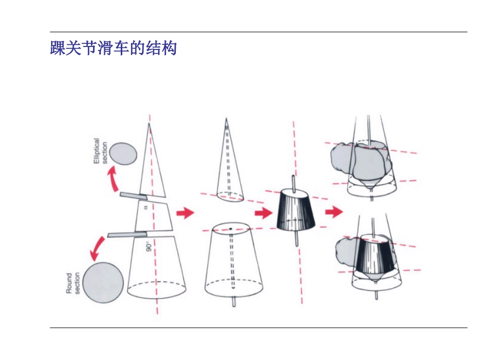 踝关节 骨折_第7页