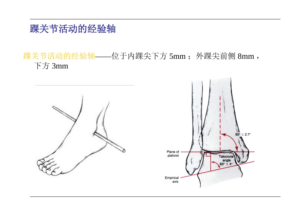 踝关节 骨折_第8页