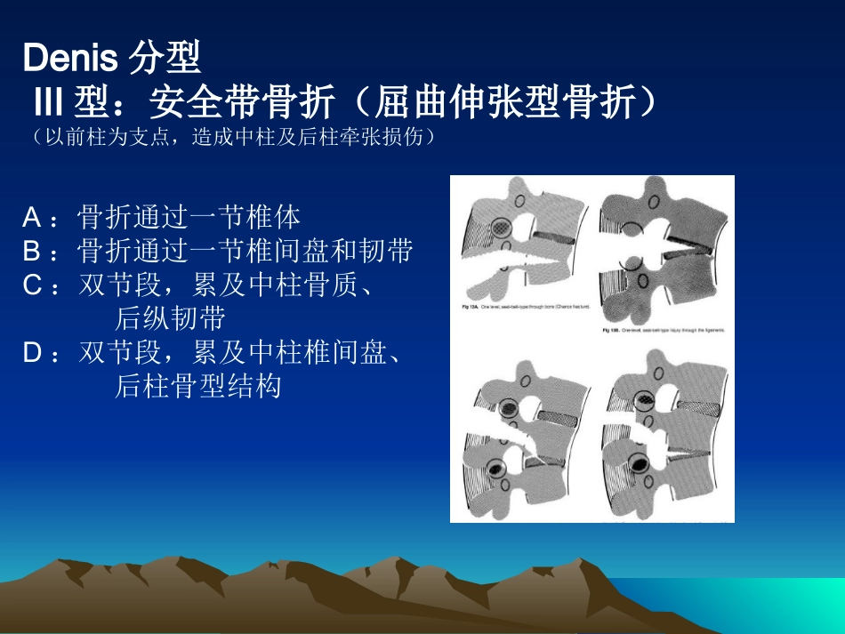 脊柱骨折 常用分型及治疗原则_第9页