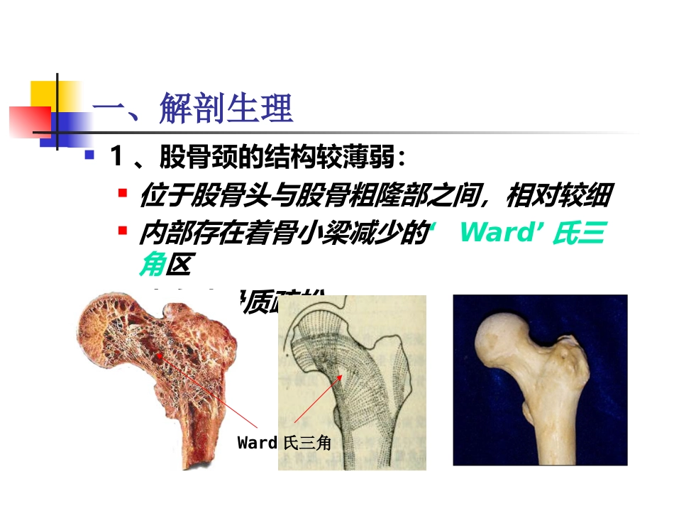 股骨颈 骨折概述_第2页