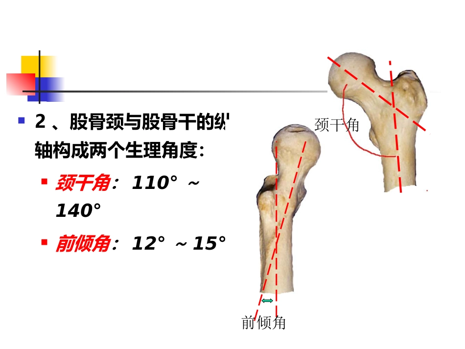 股骨颈 骨折概述_第3页