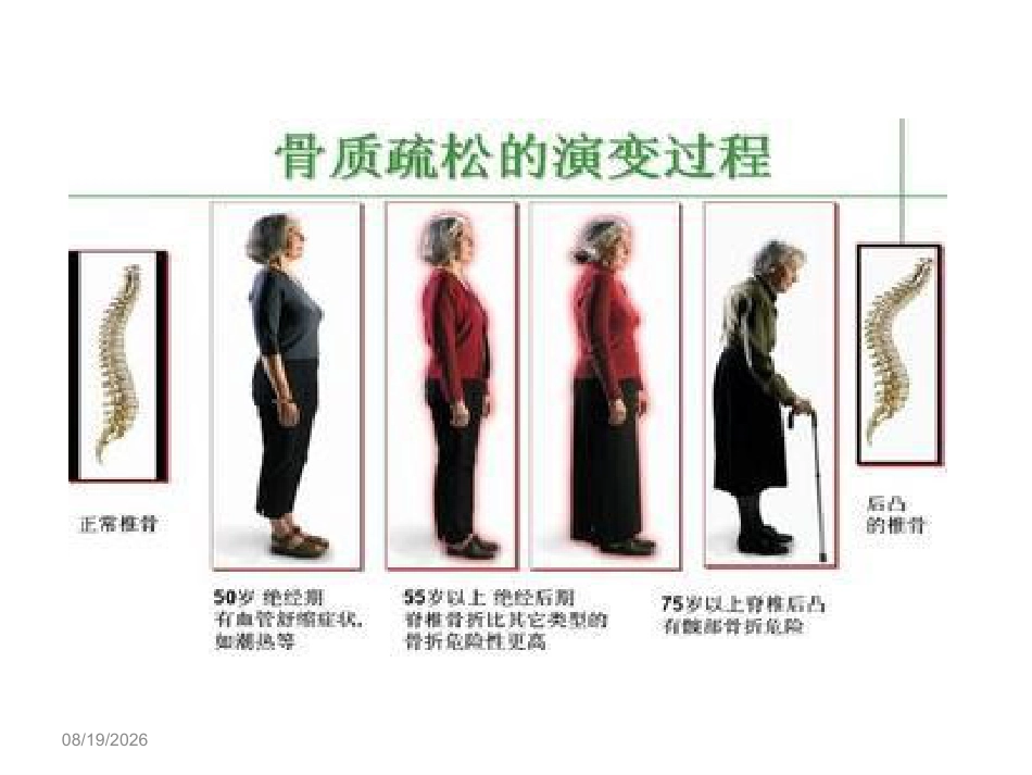 骨质疏松 的诊断与治疗_第6页