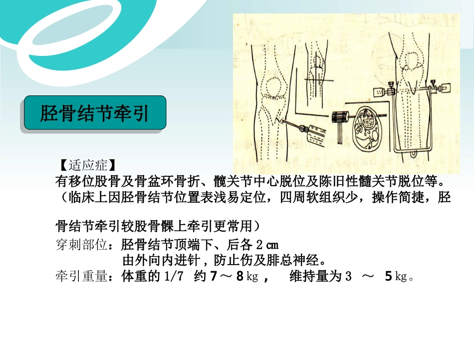 骨科 牵引术_第11页