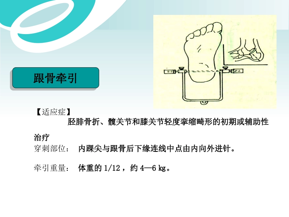 骨科 牵引术_第13页