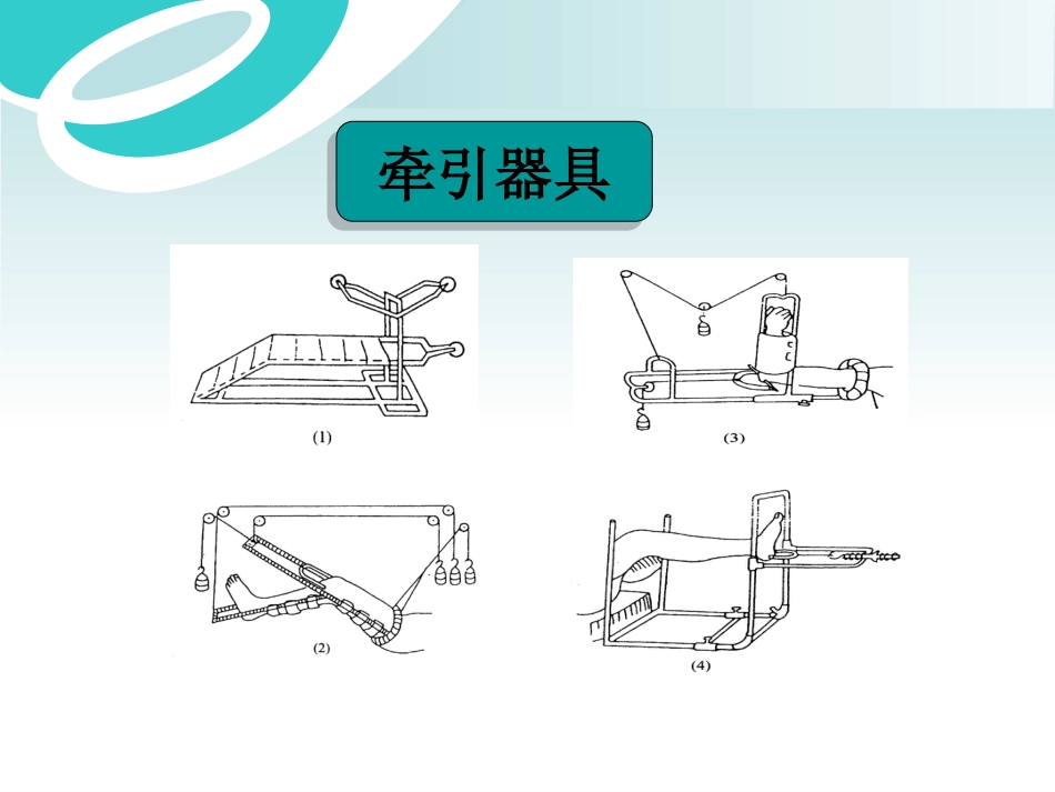 骨科 牵引术_第15页